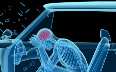 Chiropractic accident care